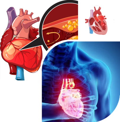 left ventricular ejection fraction