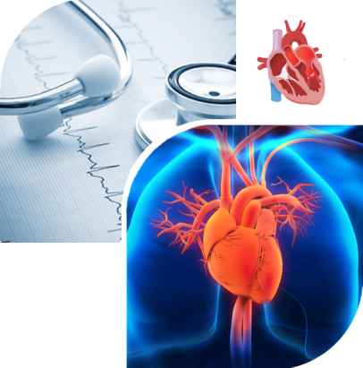 heart valve stenosis